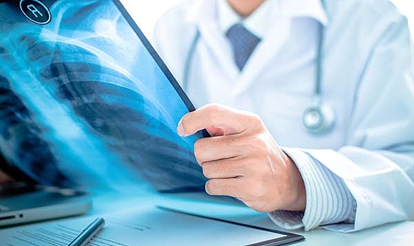 Her yıl 41 bin kişi akciğer kanserine yakalanıyor!